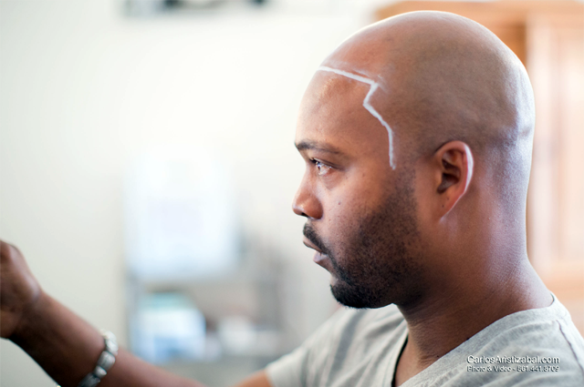 Scalp Micropigmentation Certification Training